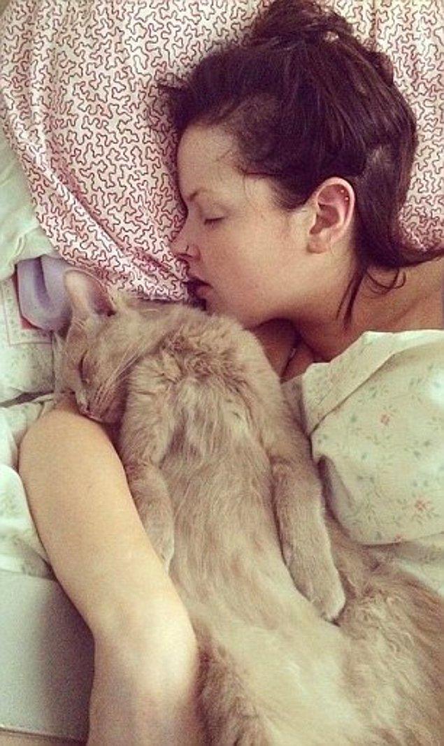Dailymail'in haberine göre Beth Godier (22) adlı hasta, bir gün koltuğunda uyuyakalır ve 6 ay boyunca uyur!