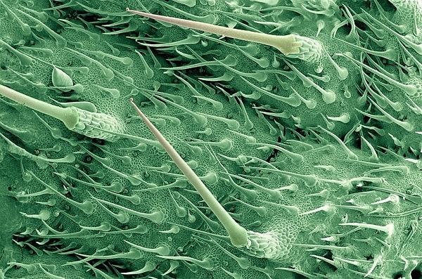 3. Эти шипы...Не раз жалили нас всех...