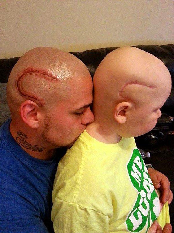 3. Oğlu içine kapanmasın diye kanser ameliyat yarasını dövme yaptıran sevgi dolu baba.