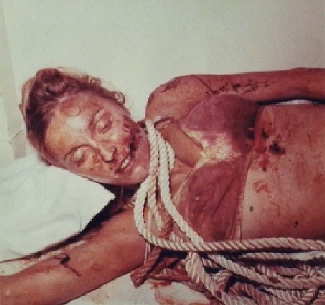 Susan Atkins, one of the followers of Manson, stabbed Sharon Tate 16 times and removed the baby using her knife.