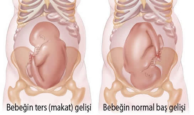 Peki, sezeryan doğum neden yapılır? Bazıları kadınların sadece zevk için sezeryan doğum yaptığını düşünüyor. Bu doğru mu? Diye soracak olursanız...