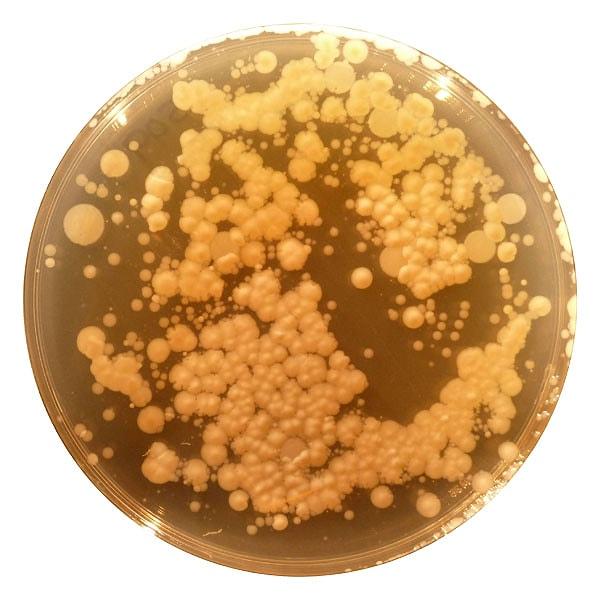 Doğada çok yaygın bulunan; Staphylococcus: