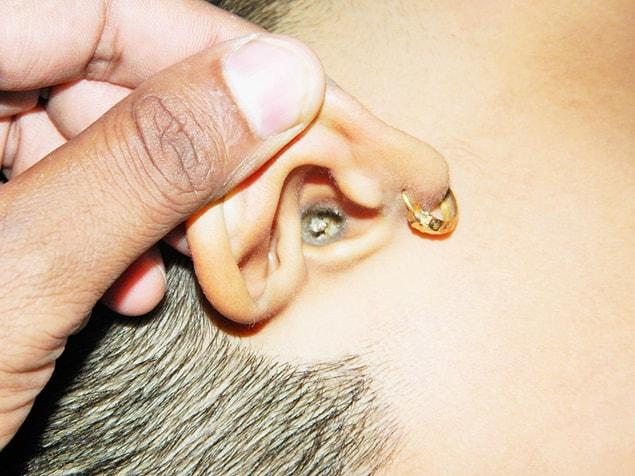15. Every year, around 150 people in USA are hospitalized because they have damaged their eardrums while 'cleaning' their ears.