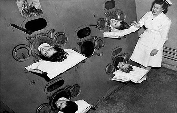 2. Çocuk felci tedavisi (1937)