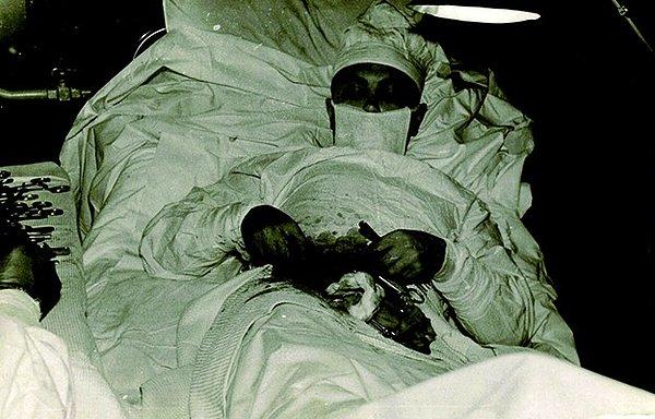14. Kendi apandisit ameliyatını kendi yapan Sovyet doktor (1961)