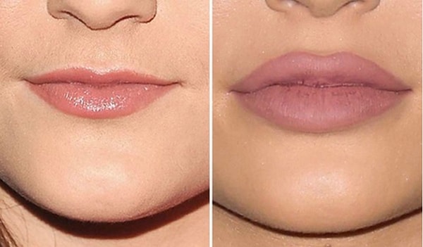 Кроме того, девушка начала удалять усы над губами. Лучше поздно, чем никогда.