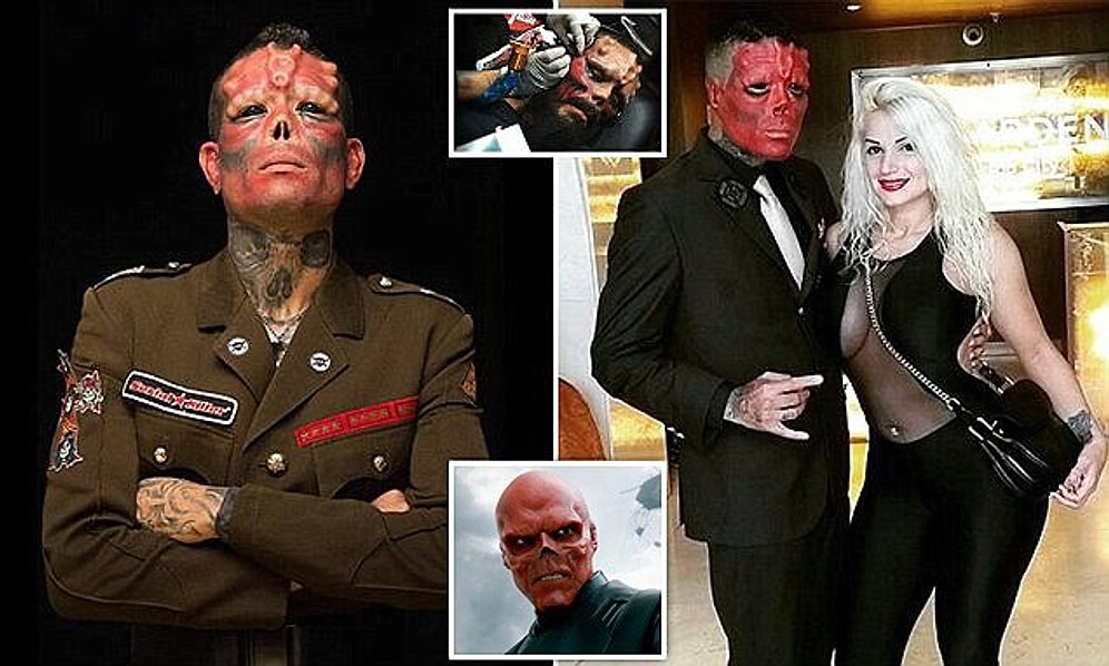 Kızıl Kuru Kafa Olmak İçin Onlarca Operasyon Geçiren 1 Çocuk Babası: Henry Rodriguez