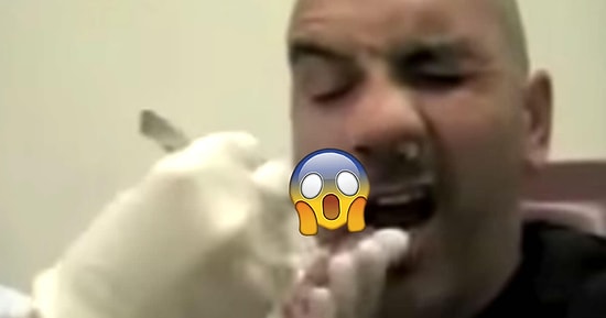 Adamın Burnundan Çıkan Nesneyi Görünce Gözlerinize İnanamayacaksınız!