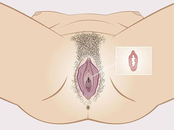 8. Kızlık zarı veya himen (hymen), kadınlarda vajinal açıklığı çevreleyen veya kısmen kaplayan zarımsı bir dokudur. Genellikle 1-2 cm kadar içeride ve 2-3 mm kalınlığındadır.