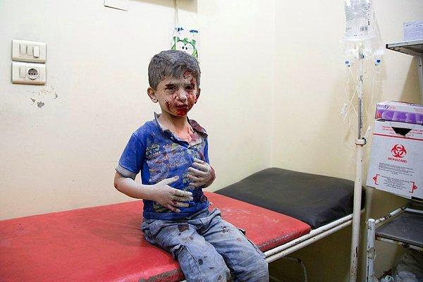 20. Şehrin doğu kısmına yapılan hava saldırılarından sona derme çatma bir hastanede tedavi edilmeyi bekleyen bir çocuk.