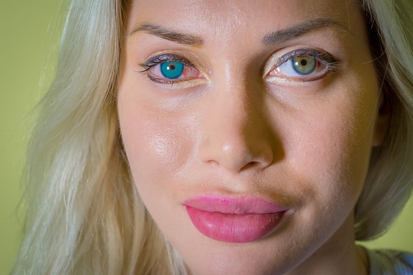 3. ...изменение цвета глаз с помощью имплантов,