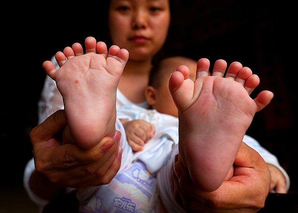 3. Çin'in Yueyang şehrinde bir anne 3 aylık oğlunun 16 ayak parmağını gösteriyor.
