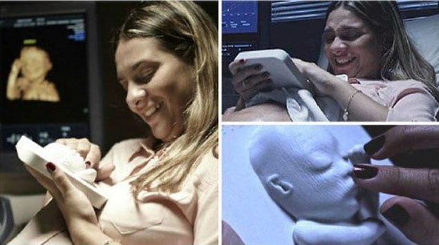 17. Artık anneler çocukları doğmadan 3D baskıyla çocuklarını hissedebiliyor.