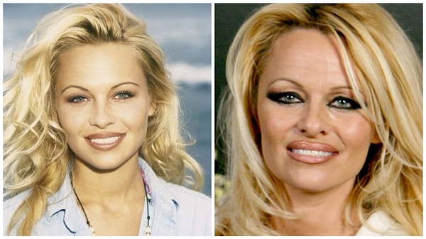 4. Памела Андерсон, 49 лет