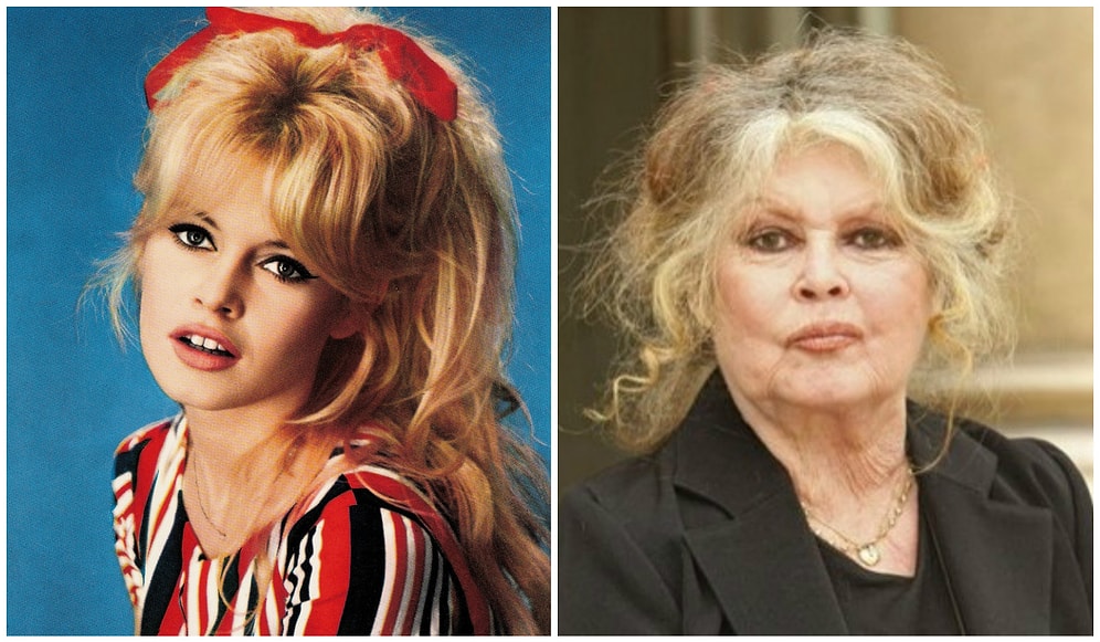 10 звезд, которые не смогли постареть красиво