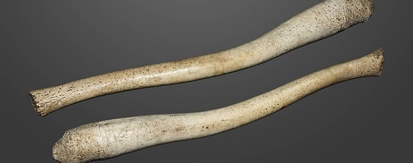 10. Выяснилось, что предки людей со временем лишились кости в пенисе, поскольку стали строить больше моногамных отношений