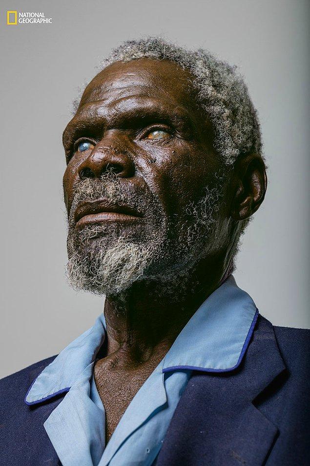 25. Namibya'nın güneşi ve kumundan ötürü zarar gören korneaları ile 67 yaşındaki Gerd Gamanab.