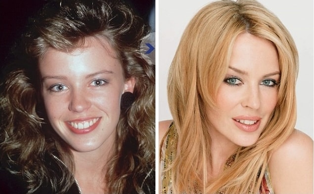 7. Kylie Minogue