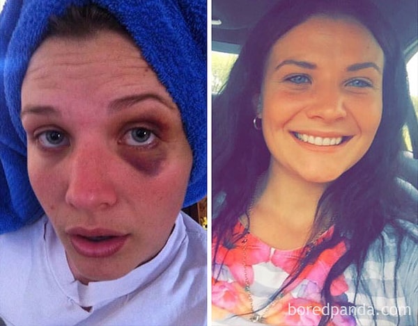 15. 106 дней без героина