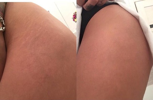 5. Айза Анохина