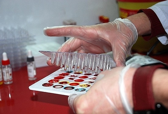 Milli Gurur: ODTÜ Öğrencisi 3 Genç Bilim İnsanından Kanserle İlgili Olağanüstü Buluş!