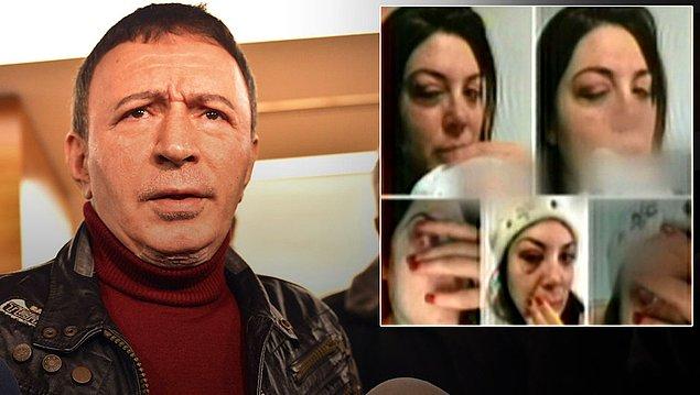 Derya Topaloğlu, bugün Instagram'da şişmiş ve yaralanmış yüzünün fotoğrafını paylaştı ve Mustafa Topaloğlu tarafından şiddet gördüğünü iddia etti!