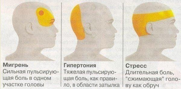 26. Если болит голова...