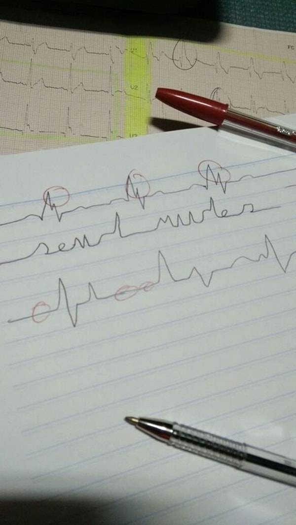 16. И даже на результатах ЭКГ?!