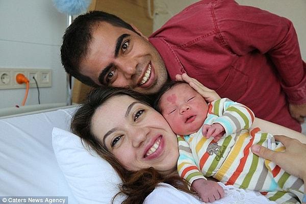 14 aylık Çınar, ailesinde doğum lekesi olan tek çocuk.