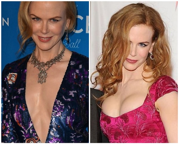 5. Николь Кидман: 15 000 долларов