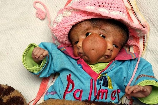 "İki Yüzlülük" Denilince Aklınıza Geleni Değiştirecek Bir Anamoli: Diprosopus