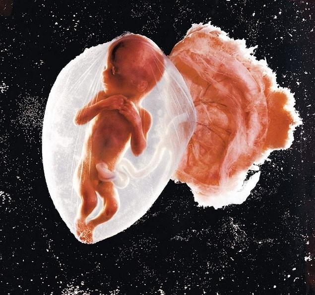 29. Fetus, 18 Weeks, Lennart Nilsson, 1965