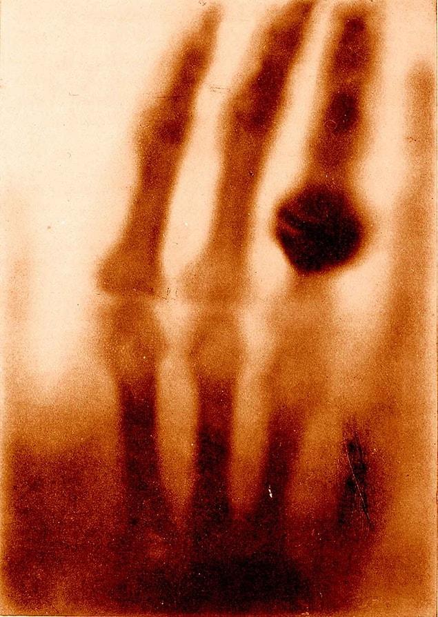 23. The Hand Of Mrs. Wilhelm Röntgen, Wilhelm Conrad Röntgen, 1895