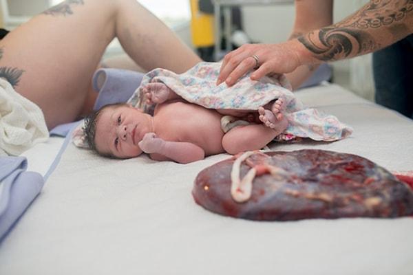 Normal doğum sırasında fetüs, doğum kanalı boyunca hareket ederken, vajinanın çevresindeki dokular gerilip, yırtılabiliyor.
