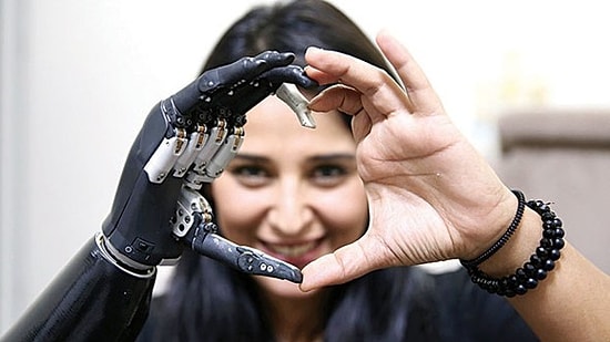 ‘Yaşama Sevinci’: İkinci Kattan Düştü, Kanseri Yendi, Trafik Kazası Geçirdi; Biyonik Koluyla Hayata Tutundu