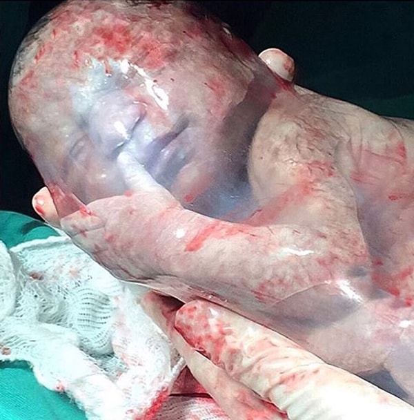 20. Ведь рождение - это настоящее чудо!