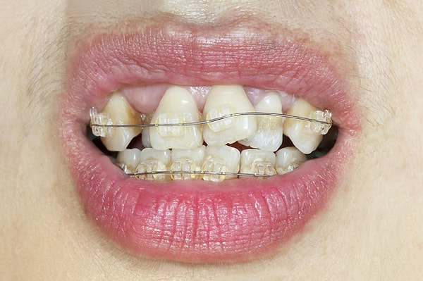 7. "Поставить бесцветную проволоку!" - такая мысль тоже посещала вас?!