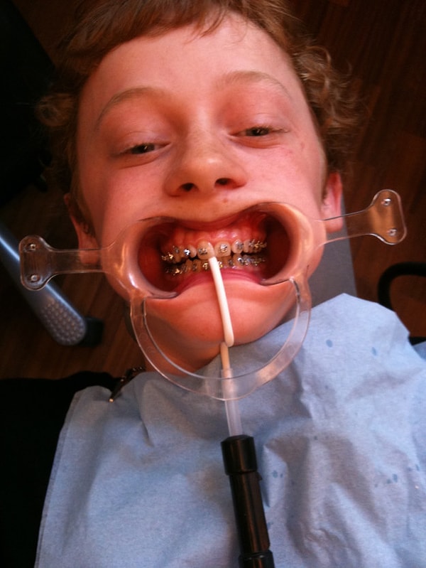 17. А чего стоит сам процесс установки...