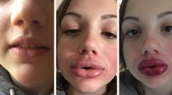 Вы думали, что это самый глупый челлендж Сети? Тогда вы еще никогда не ошибались так сильно!