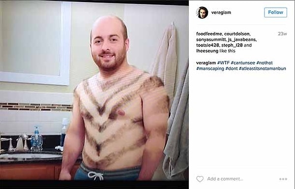 5. Человек-зебра