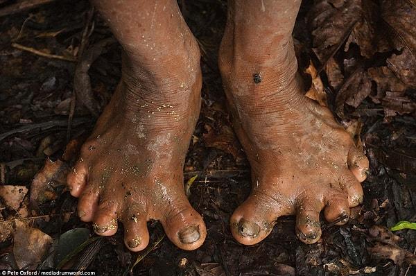 Huaorani kabilesi üyeleri o kadar çok ağaçlara tırmanıyor ki ayakları evrimleşmiş; çoğunun 6 ayak parmağı bulunuyor.
