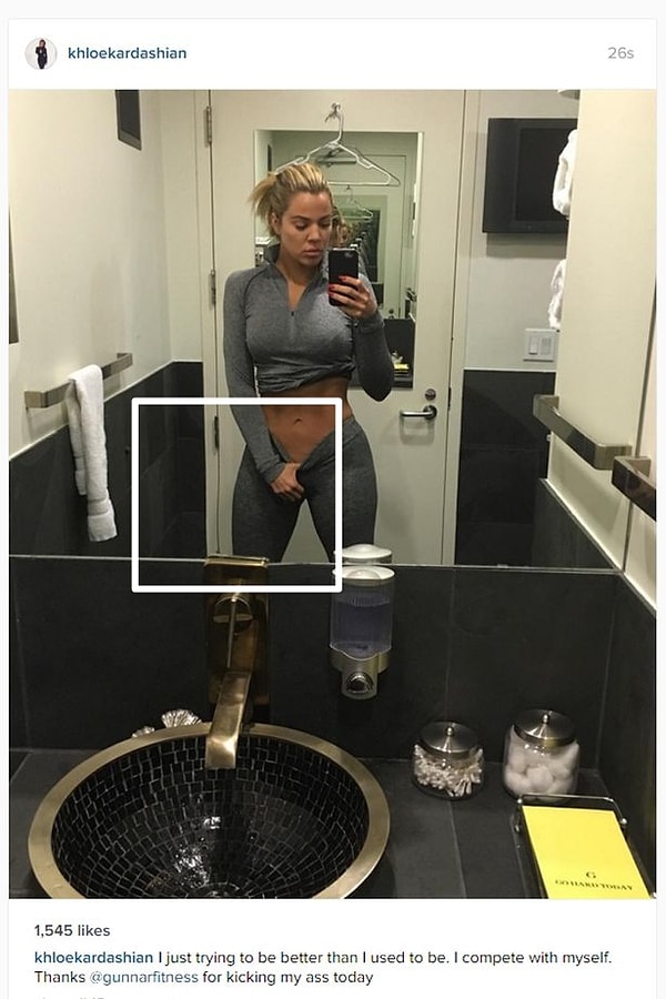 10. Очевидно, Хлои Кардашян для того, чтобы выглядеть более соблазнительной, немного поработала над ногой.