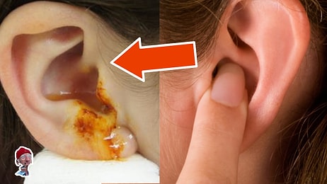 7 частей тела, которые нельзя трогать руками