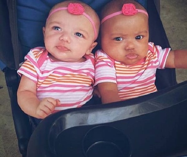 У одной из их дочерей белая кожа и голубые глаза, а у другой – смуглая кожа и карие глаза