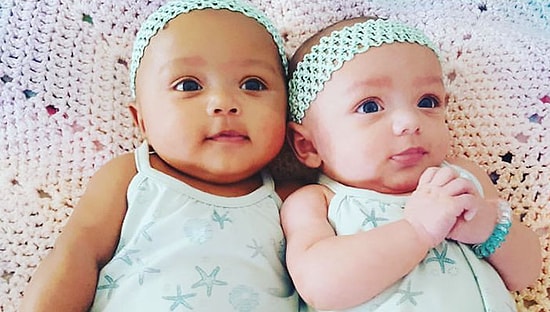 Уникальный случай: в США родились близнецы с разным цветом кожи