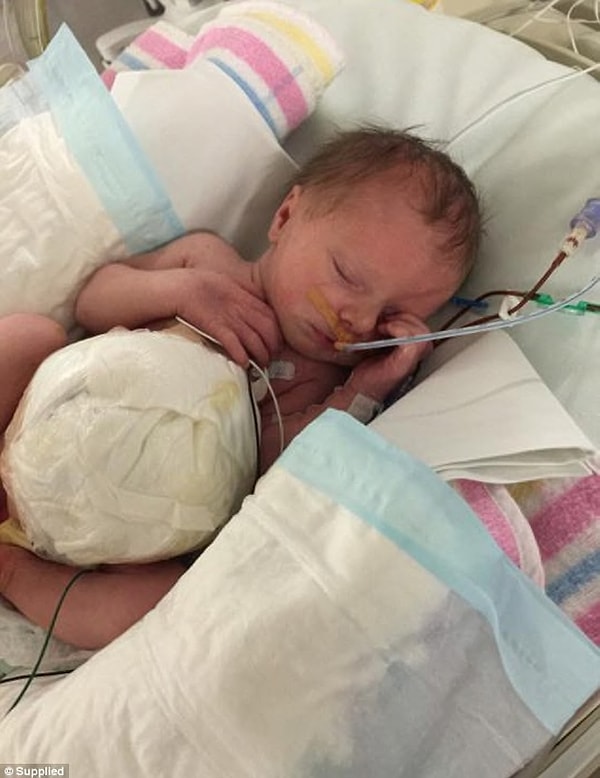 3. Азалия появилась на свет с редким отклонением, когда внутренние органы оказываются вывернутыми наружу