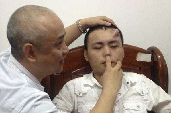 Xiaolian'ın geçirdiği trafik kazasının ardından yüzünde oluşan enfeksiyona engel olunamadı. Sebebiyse tedavi eksikliğiydi.