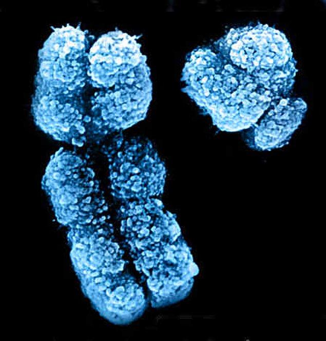 Bu bireyler mozaik genetik ile de doğmuş olabilir, yani bazı hücrelerinde XX kromozom bulunurken bazı hücrelerinde XY kromozomu bulunur.