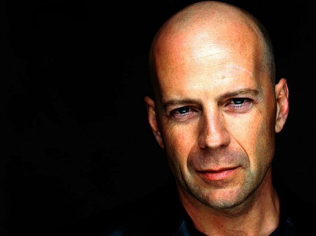 14. According to a study in 2013, bald men have a 32% higher risk of developing heart disease.