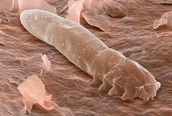 1. "Bir insanın cilt mikrobiyomunda yaşayan birçok vahşi şey vardır. Demodex bunun harika bir örneğidir; insan kıl foliküllerinin yakınında yaşayan küçük akarlar. Korkunç görünürler ve sebum, ter, ölü deri vb. ile beslenirler."